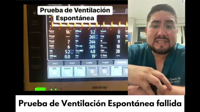 Optimización del Ensayo de Continuidad de Ventilaciones